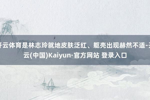 开云体育是林志玲就地皮肤泛红、躯壳出现赫然不适-开云(中国)Kaiyun·官方网站 登录入口